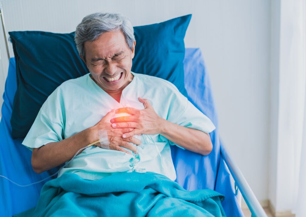 Trichomes คืออะไร